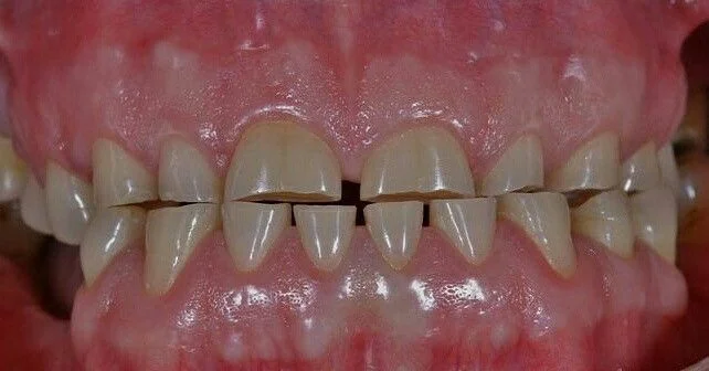 Resim - atrizyon-59f9c423