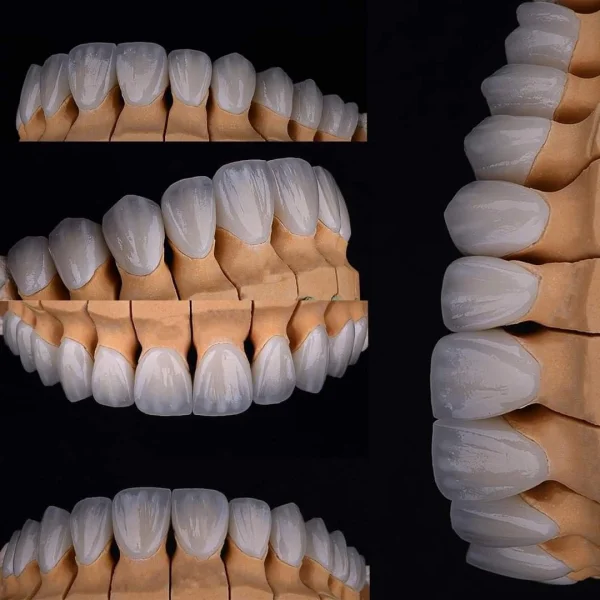 Resim - e-max-5e1a9b73