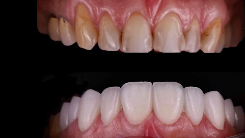 Resim - gulus-tasarimi-ankara-8ba3501a