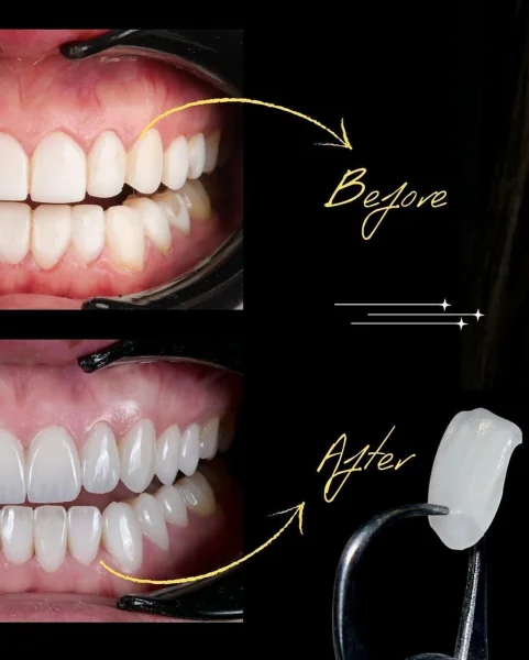 Resim - gulus-tasarimi-eyluldent-6ba0ffea