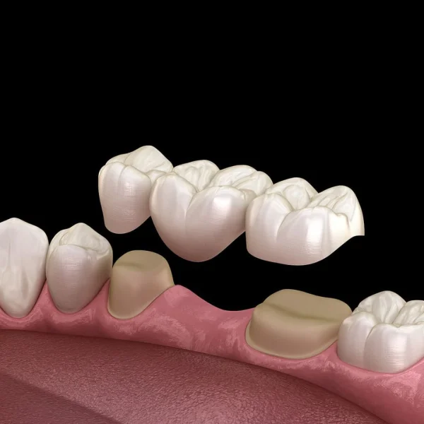Resim - dis-protez-22f8f359